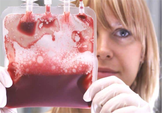 Frau hält Blutkonserve in die Kamera